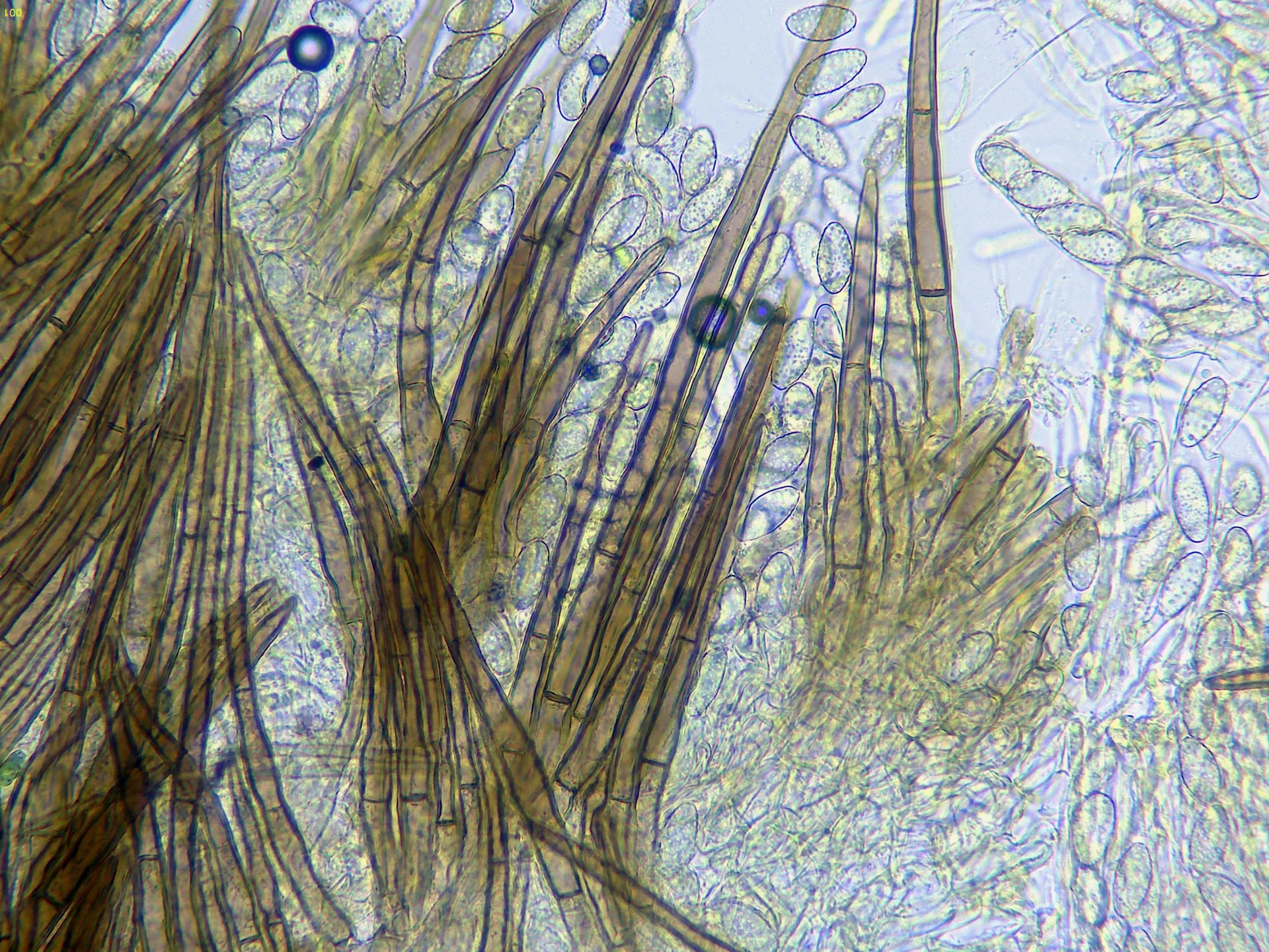 Microscopía de Trichophaea pseudogregaria - 10 - Pelos Melzer x 400-001